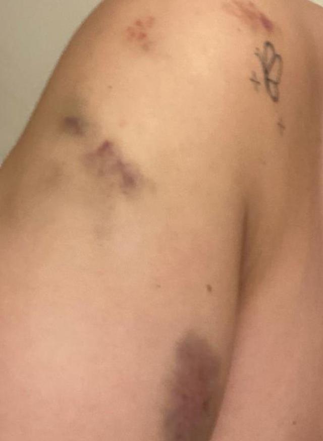 ABB çalışanının eşinden darp iddiası: Beni dövdü, belediye görevlileriyle gelip tehdit etti