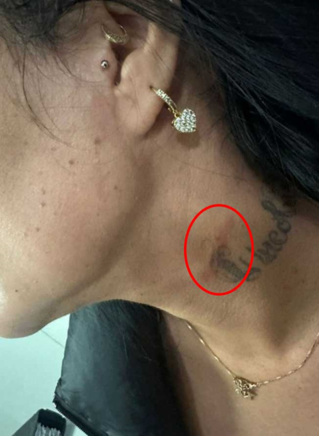 Fenerbahçeli Lincoln Henrique'nin eşi Adriana Müller, sokak ortasında saldırıya uğradı