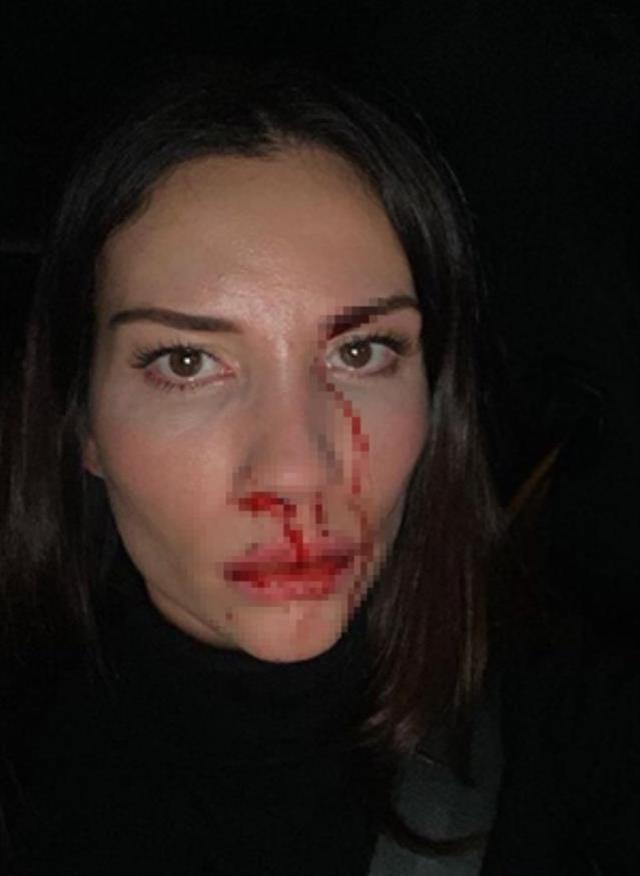 Kanlar içinde kalan eşinin iddialarına Özer Hurmacı'dan olay cevap: Hepsi yalan