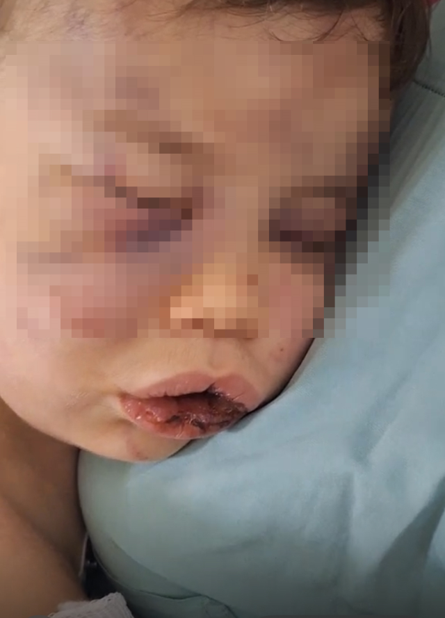 Denizli'de 2 Yaşındaki Bebek Annesinin Erkek Arkadaşı Tarafından Dövüldü