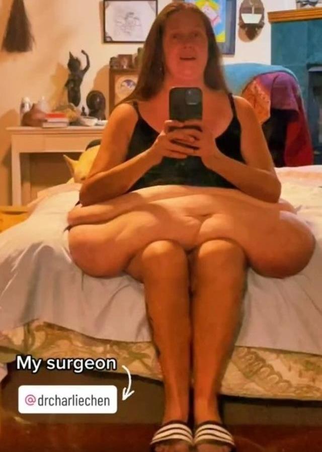 270 kilodan 167'ye düşen kadının inanılmaz değişimi! Her şeyini gözler önüne serdi 270 kilodan 167'ye düşen kadının inanılmaz değişimi! Her şeyini gözler önüne serdi