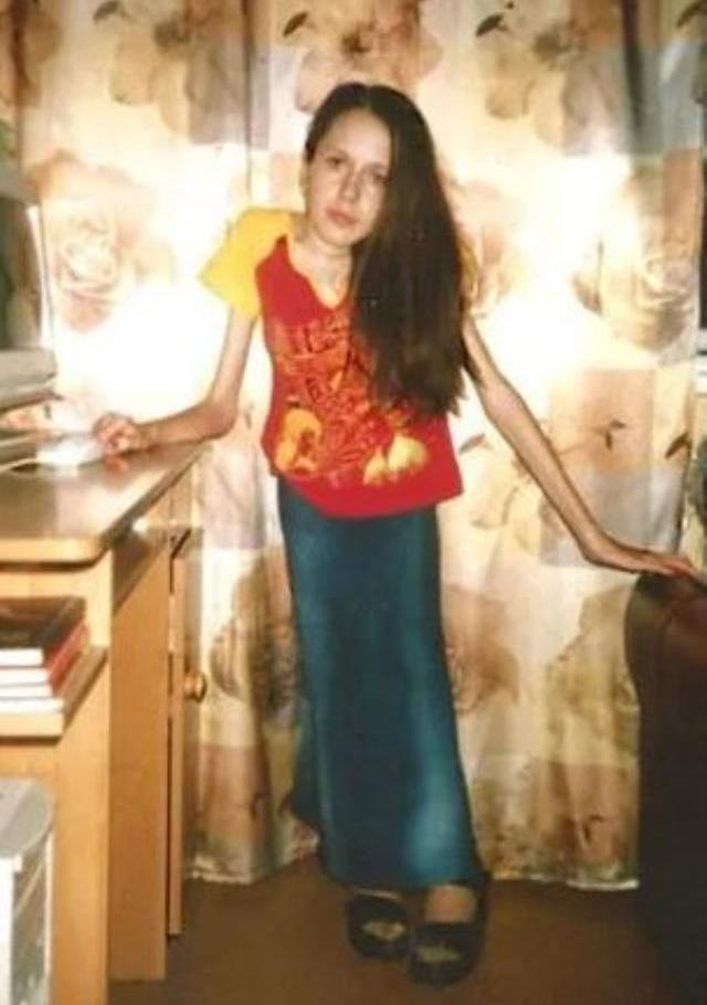 30 yıldan bu yana kalçasının üzerine oturamıyor! Hayattaki tek isteği herkesi hüzünlendirdi