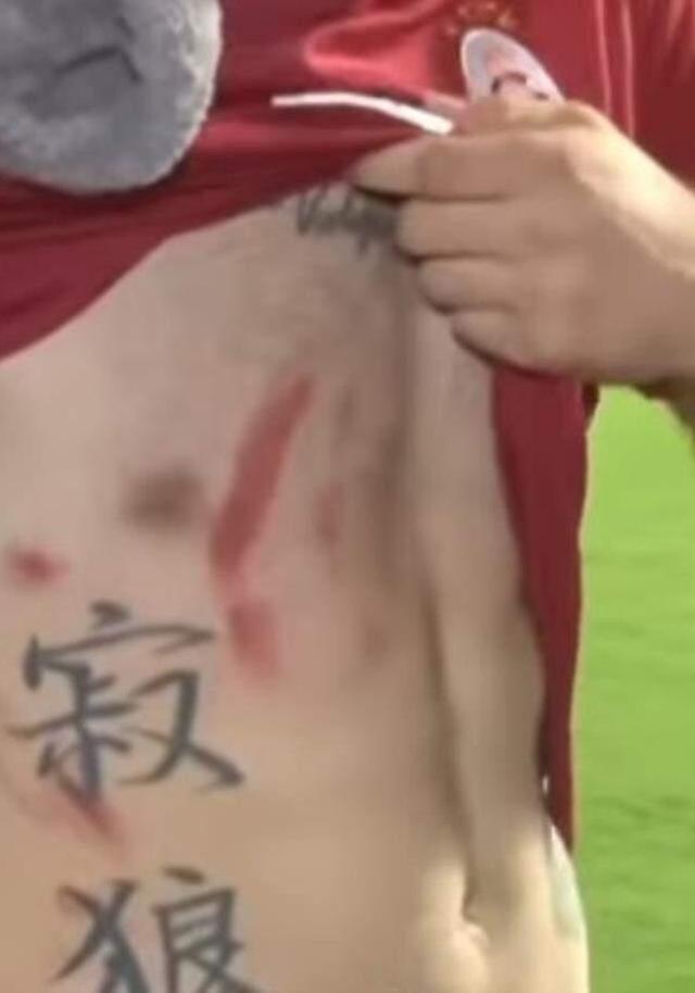 'Bu yara izleri benim gururum' diyen Alpaslan Öztürk, G.Saray taraftarının kalbini fethetti