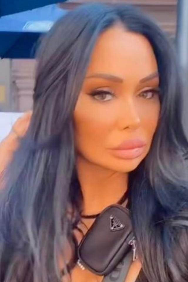 TikTok fenomenine korkunç saldırı! Video çektiği sırada suratına asit attılar