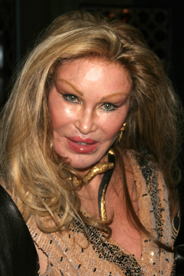 Jocelyn Wildenstein'den Acı Haber