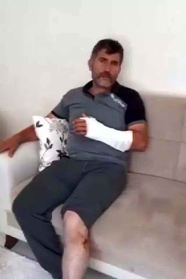 Öldü sandığı ayı saldırdı, güreşerek hayatta kaldı