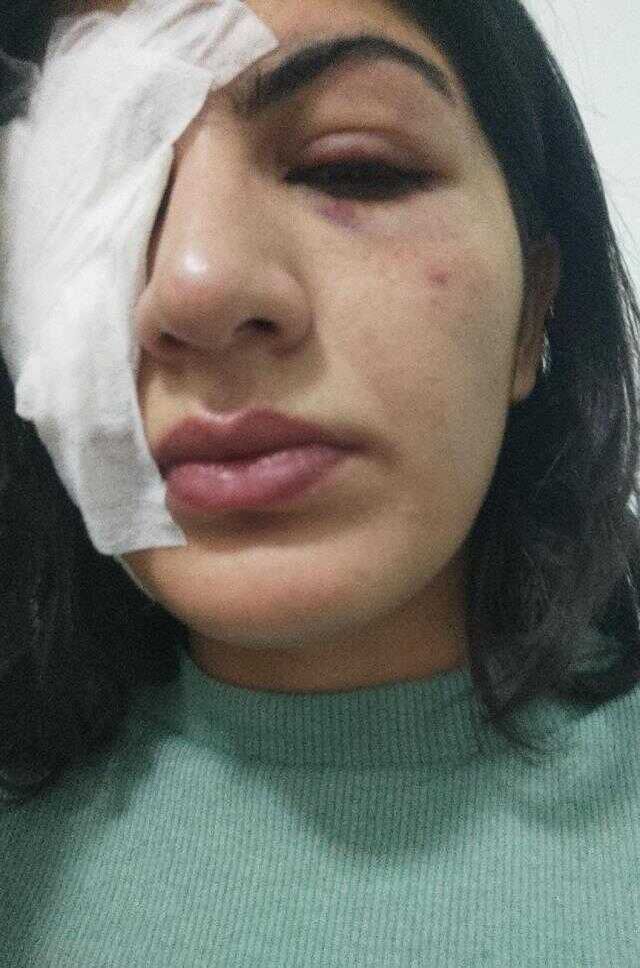 Su dolu balonla Hatice'yi gözünden yaralayan sanıklar: Şaka yaptık