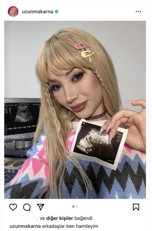 Özge Balakar hamile mi? Uzun Makarna hamile mi? TikTok fenomeni Uzun Makarna sevgilisi kim?