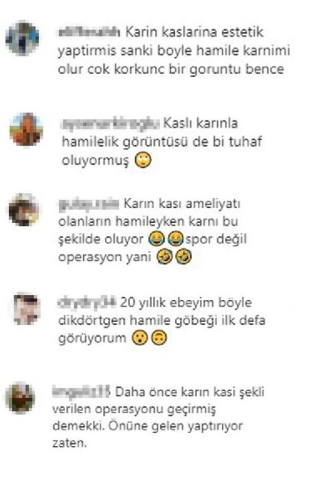 3. kez hamile olan Adriana Lima'nın göbeğinin şekli herkesi şaşkına çevirdi: 20 yıllık ebeyim ilk kez böyle gördüm