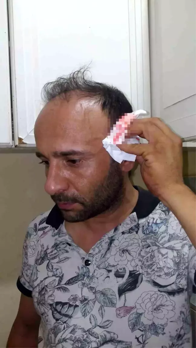 Kartal'da Kiracı, Ev Sahibinin Oğlu Tarafından Saldırıya Uğradı
