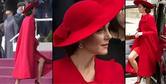 Galler Prensesi Kate Middleton Karın Ameliyatı Geçirdi