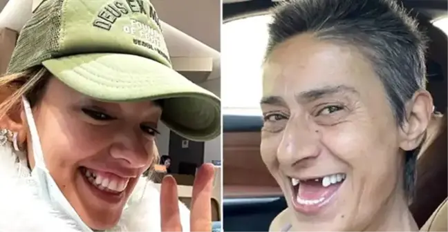 Yıldız Tilbe ve Seda Bakan'dan implant paylaşımı