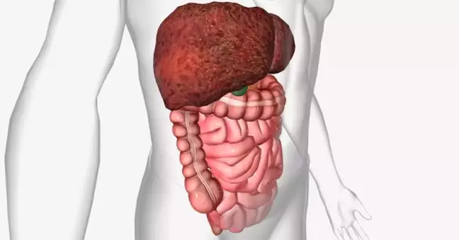 Karaciğer yağlanması nedir? Karaciğer yağlanmasının nedenleri nedir, çözümü ne?