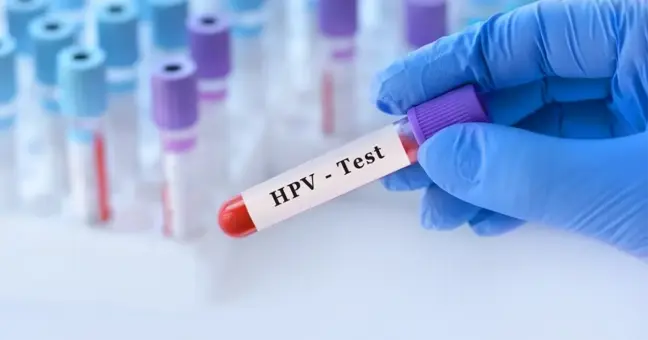 13 yaşında ölen AIDS hastası kız çocuğu olayı nedir? 13 yaşındaki kız çocuğu nasıl öldü?