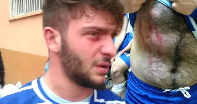 Rize'de Amatör Futbol Maçında Kavga Çıktı, 2 Futbolcu Yaralandı