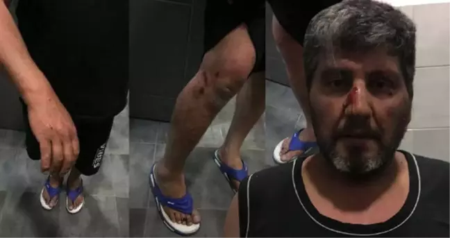 Bulgar Polisinden Gümrükte Dayak! Gözaltına Alınan Gurbetçi Aileden Haber Alınamıyor