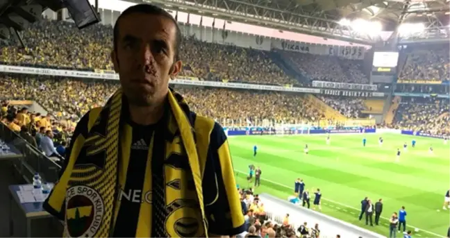 FB-BJK Maçına Davet Edilen Akciğer Kanseri Hastası Taraftar, Dün Akşam Hayatını Kaybetti