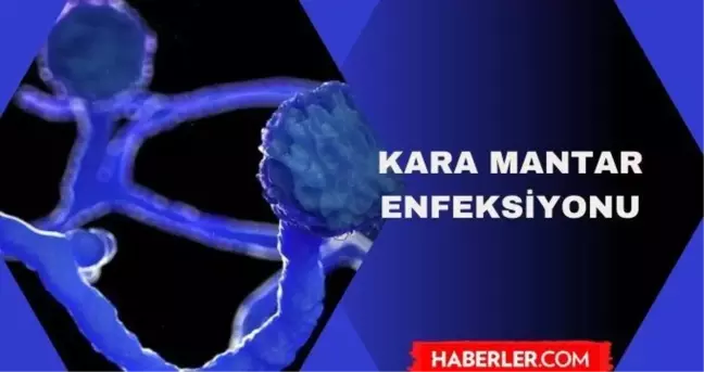 Kara mantar hastalığı bulaşıcı mı? Kara mantar enfeksiyonu nedir? Kara mantar hastalığı insana bulaşır mı?