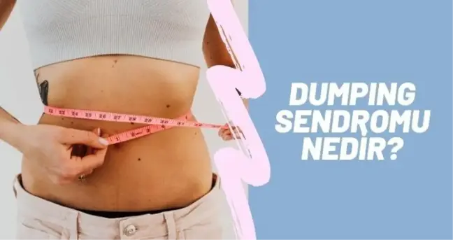 Dumping sendromu nedir? Seren Serengil'in hastalığı nedir? umping sendorumu belirtileri nelerdir? Dumping sendromu tedavisi!