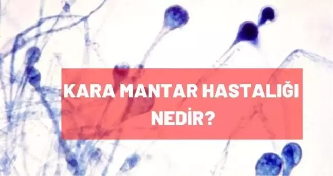 Kara mantar hastalığı nedir? Kara mantar hastalığı belirtileri nelerdir?