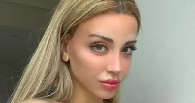 Mika Raun cinsiyet değiştirme ameliyatı kaç TL? Mika Can Raun cinsiyet değiştirme ameliyatına kaç TL verdi?