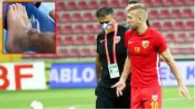 Hes Kablo Kayserispor'un yıldızı Pedro Henrique hacamat yaptırdı