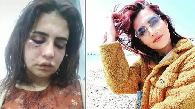 Eski sevgilisi tarafından öldüresiye dövülen Beyza'dan yardım çığlığı: Ölmek istemiyorum