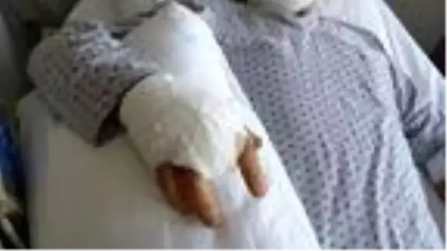 Kangren olan parmağı kesildi, 'ihmal' iddiasına soruşturma açıldı