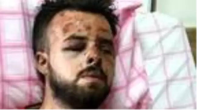400 metreden uçuruma yuvarlanan kamyonetten kurtulan baba-oğul, kazayı anlattı