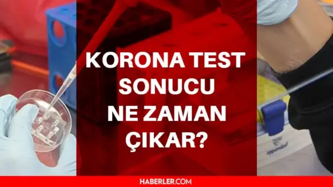 PCR testi sonucu ne zaman çıkar? Korona testi ne zaman çıkar? Covid testi ne zaman, kaç günde çıkar?