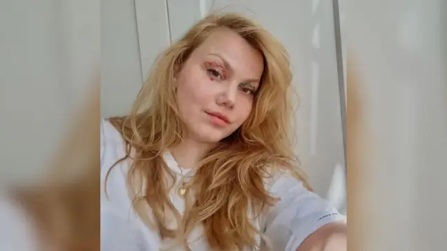 Merve Veziroğlu Yıldırım sağlık durumu nasıl? Youtuber Merve Veziroğlu Yıldırım son durumu ne?