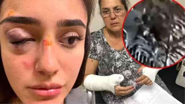 Görüntüler ortaya çıktı... Ünlü manken ve annesini böyle darp etmiş!