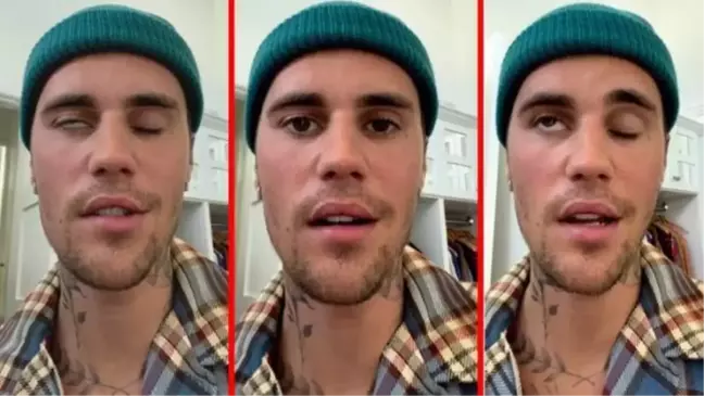 Justin Bieber felç mi oldu? Justin Bieber sağlık durumu ne?