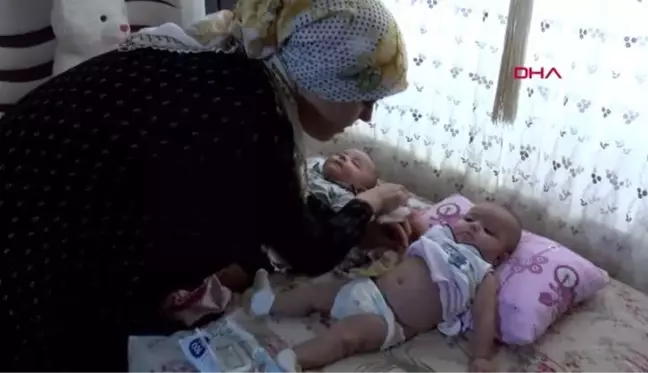 Ecrin bebek için sevindirici ameliyat olacak