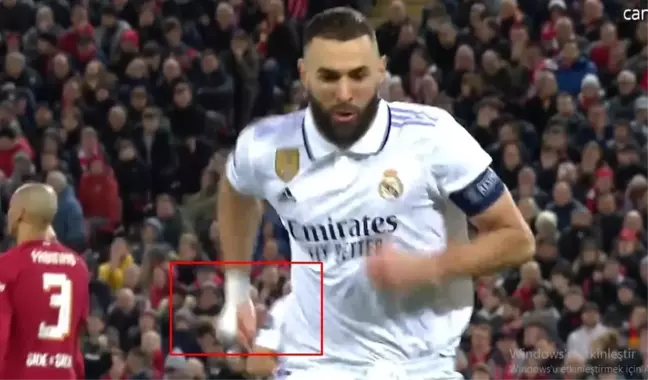 Benzama eli neden bandajlı? Benzama elinde neden bandaj var?