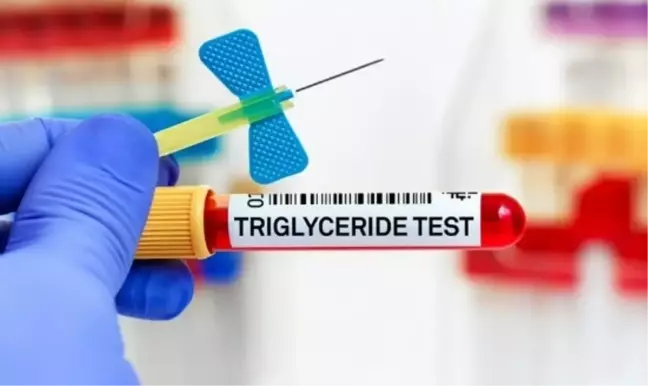 Trigliserid yüksekliği neden olur? Trigliserid belirtileri neler?