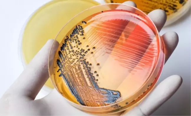 Salmonella nedir? Salmonella nereden bulaşır?