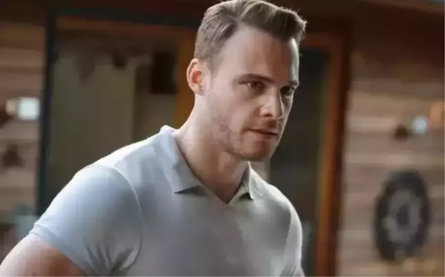 Kerem Bürsin saç mı ektirdi?