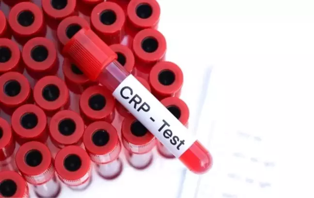 CRP NEDEN YÜKSELİR? CRP nedir, normal değeri kaç?