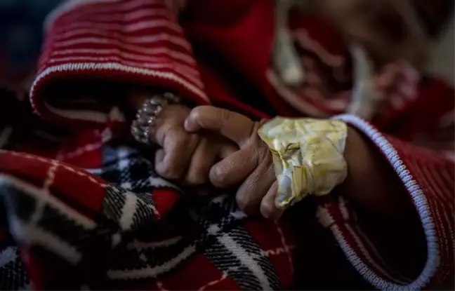 Abluka Yemen'de Sağlık Hizmetlerine Erişimi Daha da Zorlaştırıyor