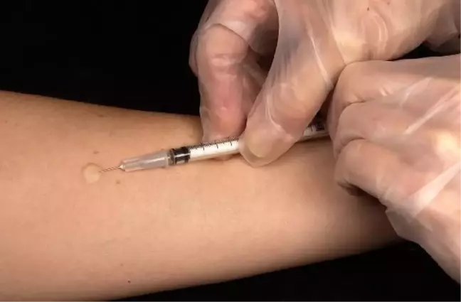 ABD, Chikungunya virüsüne karşı aşının onayını verdi