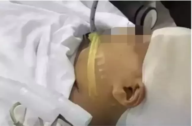 Öğretmen 9 yaşındaki öğrencisinin kafasına metal cetvelle vurarak kafatasını parçaladı