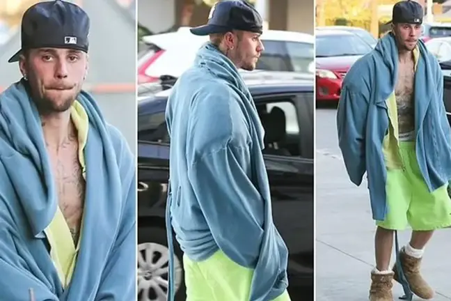 Justin Bieber'ın üstsüz ve dağınık görüntüsü hayranlarını endişelendirdi