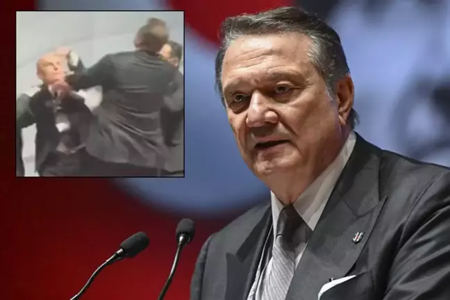 Divan Kurulu'nda yumruklanan Beşiktaş'ın eski başkanı Hasan Arat, darp raporu aldı