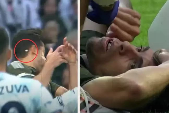 Beşiktaş'ta üst üste şanssızlıklar! 2 sakatlık, bir de dişi kırılan futbolcu