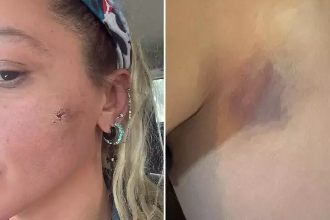 Yıldız Asyalı kocasından şiddet gördüğünü açıkladı