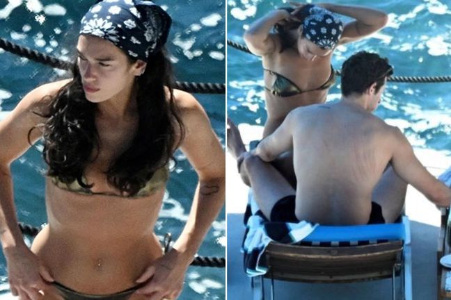 Dua Lipa'nın eşinin sırtındaki izler dikkat çekti