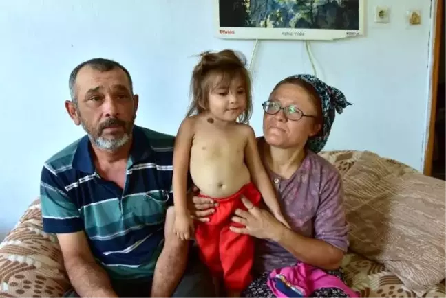 Skolyoz hastası Cansu, ameliyat olmayı bekliyor