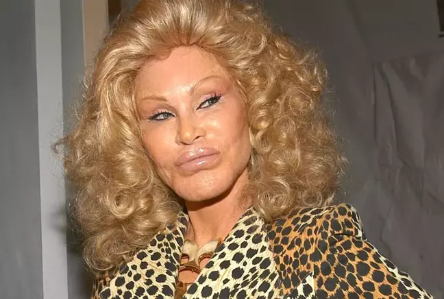 'Kedi Kadın' lakaplı Jocelyn Wildenstein hayatını kaybetti