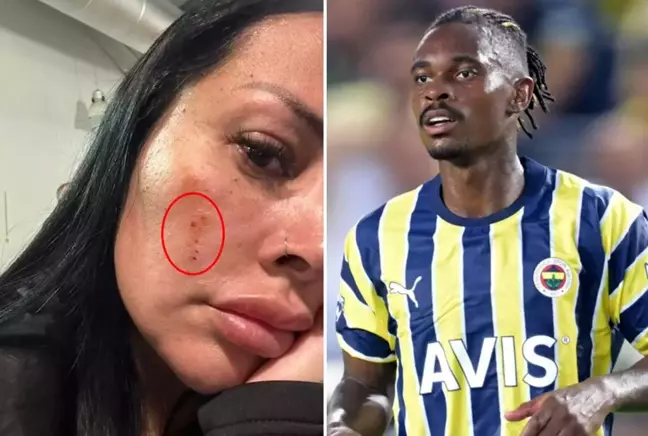 Fenerbahçeli Lincoln Henrique'nin eşi Adriana Müller, sokak ortasında saldırıya uğradı